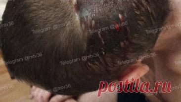 Подростки ради забавы напали на прохожего и разбили ему голову. В Воронеже трое школьников напали на мужчину и разбили ему голову, потому что это показалось им смешным. Об этом сообщается в Telegram-канале "мой и твой Воронеж". Инцидент произошел на улице Машиностроителей. По словам ...
