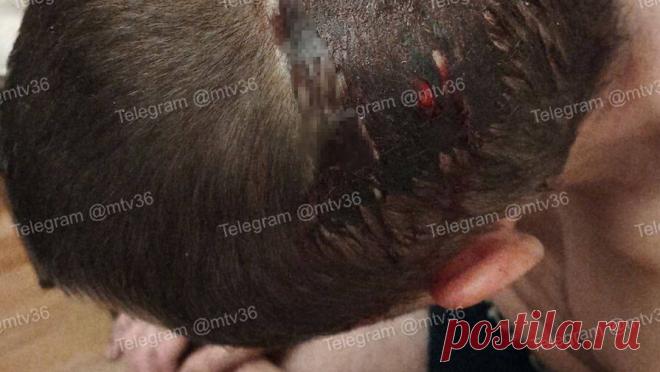 Подростки ради забавы напали на прохожего и разбили ему голову. В Воронеже трое школьников напали на мужчину и разбили ему голову, потому что это показалось им смешным. Об этом сообщается в Telegram-канале "мой и твой Воронеж". Инцидент произошел на улице Машиностроителей. По словам ...