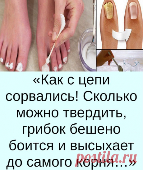 Скажем грибку нет! Как вылечить грибок без хирургии в домашних условиях.
БЛОГ - ВСЕ О КРАСОТЕ И ЗДОРОВЬЕ НОГТЕЙ ОТ ЕЛЕНЫ СОКОЛОВОЙ.
Итак, для начала, что такое грибок?

Грибок - это инфекция. Оседая на коже, она вызывает размягчение и разрушение верхнего слоя эпидермиса, от чего появляется сухость. Далее споры грибка проникают в наш организм и паразитируют, разрушая белковые клетки и питаясь ими.
летний маникюр
От этого наши ногти утолщаются, слоятся и приобретают неприятный