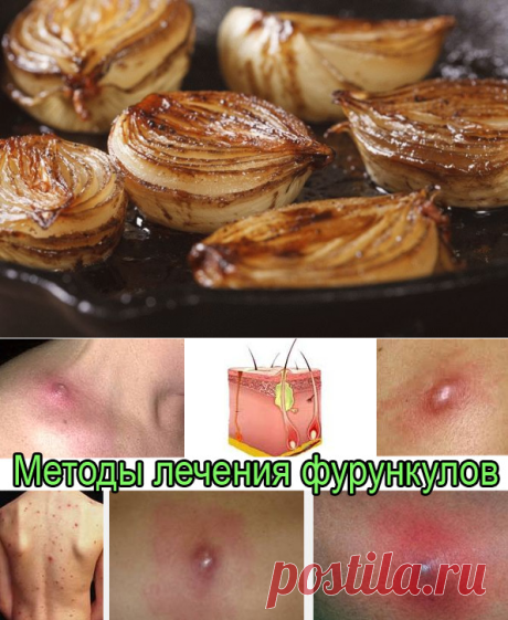 Запеченный лук спасет от недуг — Всегда в форме!