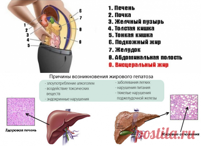 Узнайте, что такое висцеральный жир и чем он опасен