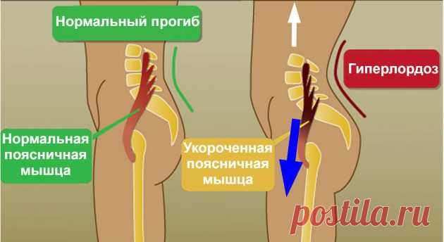Наклоняйся и будешь здоров В народе говорят - если хочешь быть здоровым, то почаще наклоняйся. И это не просто народная мудрость, а вполне обоснованная и логичная концепция. При наклоне работает поясничная мышца, являющаяся сам…