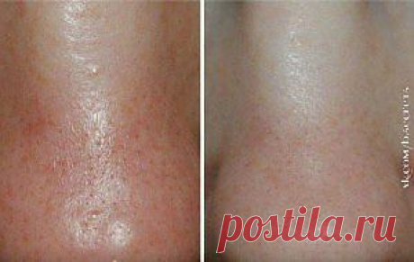 умывание овсянкой