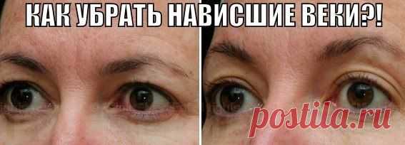 убрать нависшие веки