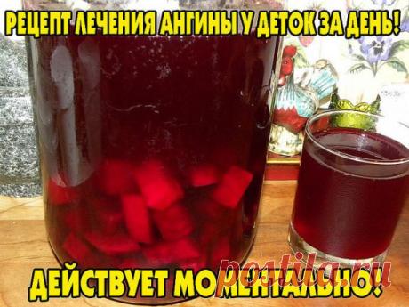 Рецепт лечения ангины.