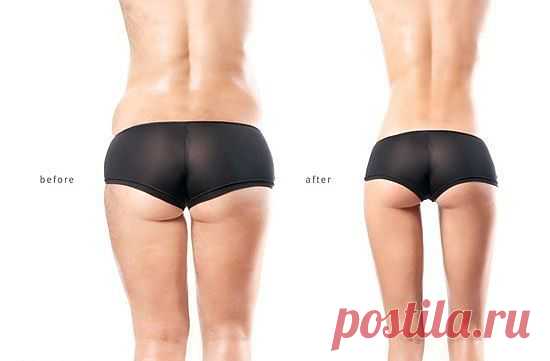 *Какой у вас обмен веществ? (тест и рекомендации по питанию).