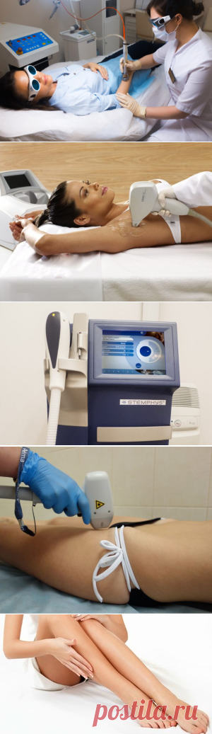Лазерная эпиляция: больно или нет?