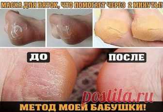 МАСКА ДЛЯ ПЯТОК, ЧТО ПОМОГАЕТ ЧЕРЕЗ 2 МИНУТЫ!

МЕТОД МОЕЙ БАБУШКИ!

Гладкие, шелковистые пяточки в любое время года — мечта женщины. Шершавые пятки превратить в идеал, можно благодаря нашим стараниям.


Ниже вас ждет народный, действенный рецепт избавления от твердых и шершавых пяток (проверенный на собственном опыте)... 

Компресс из репчатого лука 




Этот компресс делается перед сном и оставляется на всю ночь. 

Процедуру повторить до пяти раз. 

1. Луковицу мелко поре...