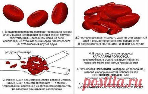 Состояние опьянения - это отмирание клеток мозга.