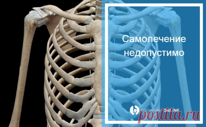Что делать если сломано ребро - как лечить