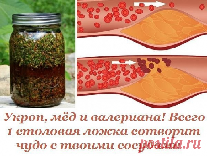 Как почистить сосуды. - 20 Ноября 2017 - Полезные советы для женщин
