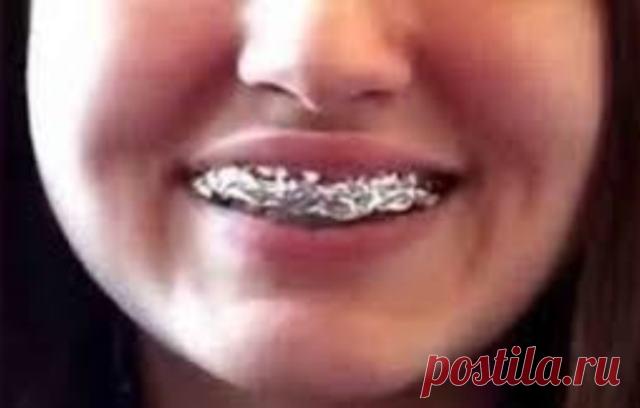 Только взгляните, что произойдет, если обернуть зубы в обычную фольгу. Результат ошеломляет.