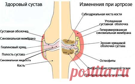 ГИМНАСТИКА ДЛЯ КОЛЕННЫХ СУСТАВОВ