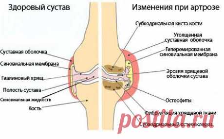ГИМНАСТИКА ДЛЯ КОЛЕННЫХ СУСТАВОВ