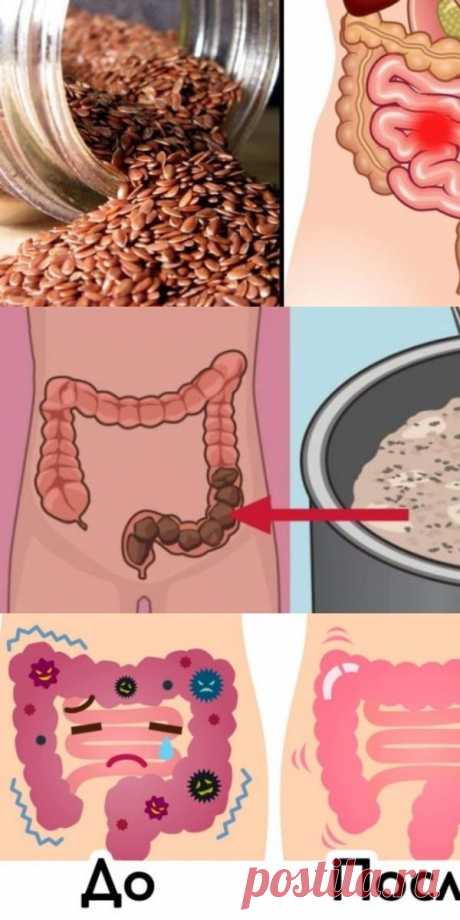 Очищение кишечника и омоложение всего организма простым способом. Потрясающий результат!