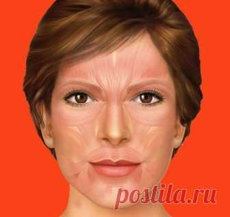 Техника Коруги поднимает щеки, устраняет отеки и провисания!