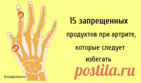 15 запрещенных продуктов при артрите, которые следует избегать 15 запрещенных продуктов при артрите, которые следует избегать. Если вы страдаете артритом, то вы знаете ту боль, которая сопровождает