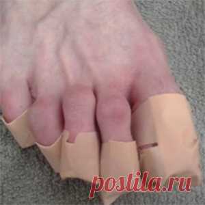 Недорогое средство от грибка ногтей: список дешевых средств