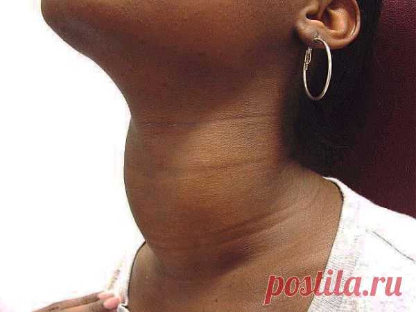 Показатели здоровья щитовидной железы | Я ЗДОРОВ!