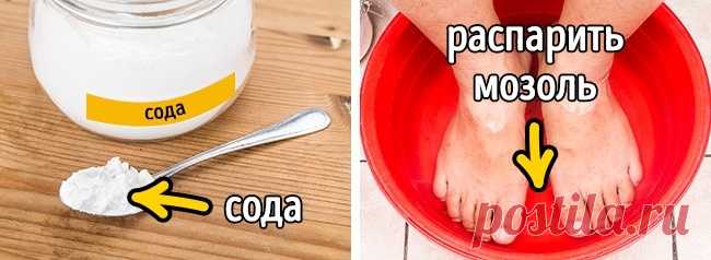11 легких способов вылечить мозоль от неудобной обуви