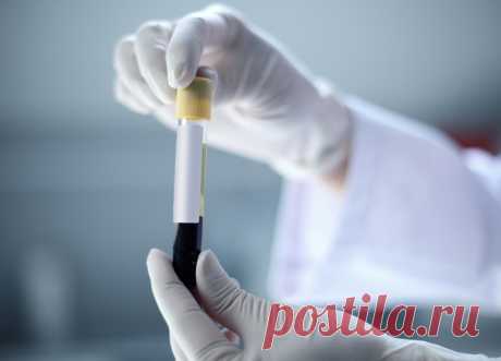 Энциклопедия - Анализ крови на гормоны щитовидной железы и ТТГ