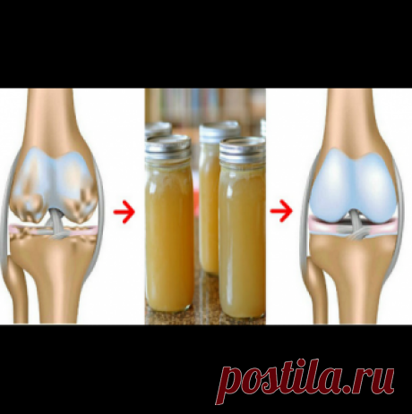 Лекарите са изумени! Тази рецепта,създадена от древните гърци, укрепва и възстановява костите, коленете и ставите - За Жената Лекарите са изумени! Тази рецепта,създадена от древните гърци, укрепва и възстановява костите, коленете и ставите - Според многоздравни експерти, неправилна...