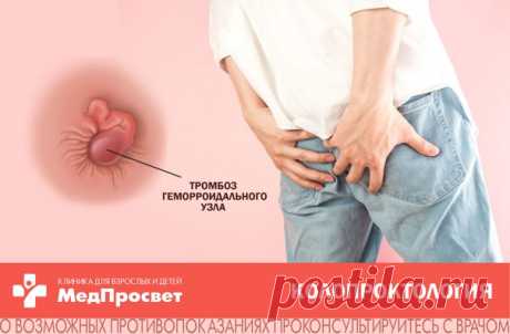 Тромбоз геморроидального узла: что это такое и как лечить?

Стоит отметить, что тромбоз не выделяется, как отдельное заболевание, а является осложнением основного заболевания - геморроя (расширении вен прямой кишки). При отсутствии лечения и наличии провоцирующих факторов в геморроидальном узле образуется сгусток крови - тромб, который провоцирует воспалительный процесс и острый болевой синдром.
Показать полностью...