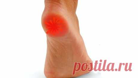 Как быстро вылечить шпору на пятке народными средствами?
Поделюсь рецептами от пяточных шпор. Прошлым летом на юге после ванн у меня так разболелась нога, что я не знала, куда ее деть. Пятка горела огнем. Приехав домой, побежала к хирургу. Молодая врач сделала снимок и объявила, что у меня после ванн обострилась пяточная шпора. Дала мне какую-то «памятку» – и все. Я поняла, что […]
Читай пост далее на сайте. Жми ⏫ссылку выше