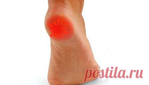 Как быстро вылечить шпору на пятке народными средствами?
Поделюсь рецептами от пяточных шпор. Прошлым летом на юге после ванн у меня так разболелась нога, что я не знала, куда ее деть. Пятка горела огнем. Приехав домой, побежала к хирургу. Молодая врач сделала снимок и объявила, что у меня после ванн обострилась пяточная шпора. Дала мне какую-то «памятку» – и все. Я поняла, что […]
Читай пост далее на сайте. Жми ⏫ссылку выше