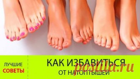 КАК ИЗБАВИТЬСЯ ОТ НАТОПТЫШЕЙ!!!
-------------------------------------------------------------------------------------------
Чтобы не потерять совет , жмите  поделиться.
-------------------------------------------------------------------------------------------
Требуется: 

Мыльно-содовая ванночка для ног: 
1. сода, 
2. хозяйственное мыло, 
3. вода 

Маска от натоптышей: 
1. аспирин, 
2. лимонный сок, 
3. вода, 
4. полиэтилен