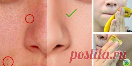 5 удивительных способов использования банановых пилингов для вашей кожи - Упражнения и похудение Невероятный эффект! Люди едят банан перед сном, если у них проблемы со сном. Но знаете ли вы, что вы можете использовать его для кожи? 5 различных способов использования банановой кожуры 1. Освобождает от симптомов экземы, прыщей и псориаза Банановая кожура может снизить зуд и воспаление, которое сопровождает серьезные состояния кожи, такие как псориаз, угри и экзема. …