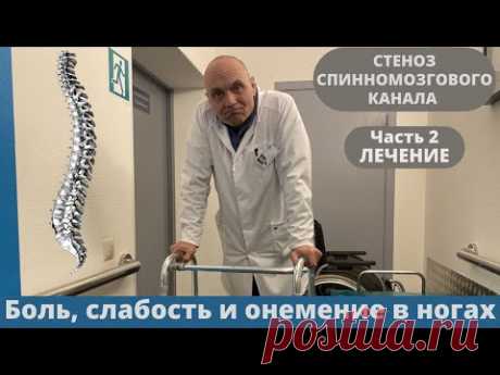 ЛЕЧЕНИЕ СТЕНОЗА СПИННОМОЗГОВОГО КАНАЛА. КОГДА БОЛЯТ И НЕМЕЮТ НОГИ. Часть 2