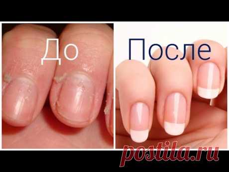 ✦ Как сделать чтобы кутикула не росла - ЛАЙФХАК