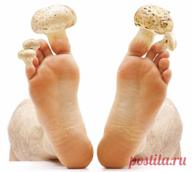 5 лучших средств от грибка ногтей — ТОП 5

Качественное лечение, которое обеспечивает это средство, обусловлено ... Масло чайного дерева лучшее народное средство от грибка ногтей. ... Из отзывов: «Пришлось лечить рецидивирующий грибок на ногах во время беременности.