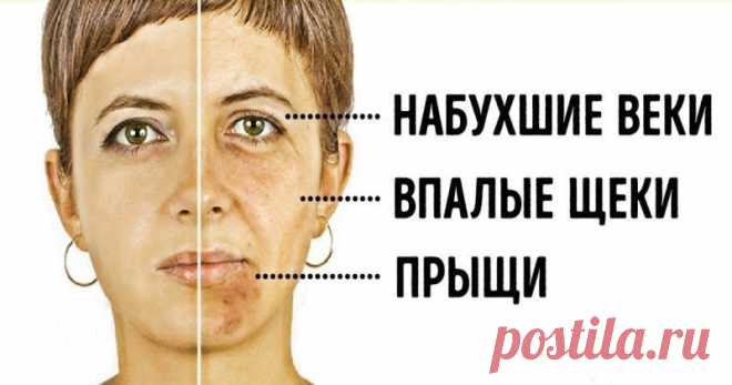 Проблемная кожа лица: забудьте о 4 продуктах и станьте красивой