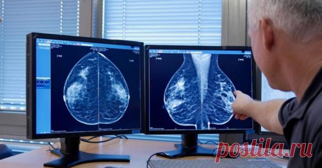 Рак, который вас никогда не убьет. Чем опасна гипердиагностика онкологии и какова цена за ненужный скрининг Отрывок из книги «Ящик Пандоры. Семь историй о том, как наука может приносить нам вред»