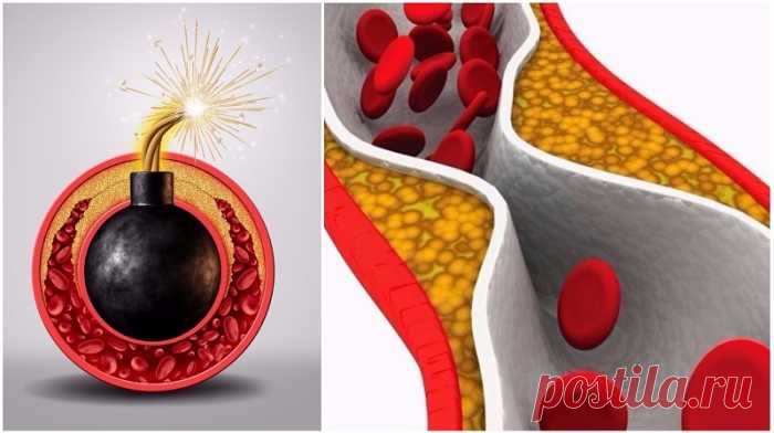 Тушари Джалаят: «Если тебе за 30, чистка сосудов — вопрос выживания!» — Домашние заботы