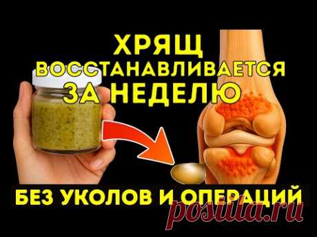 Хруст в коленях? Ешьте это каждый день — и суставы начнут восстанавливаться!
