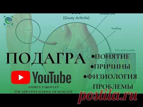 ПОДАГРА. Понятие. Причины появления. #ФИЗИОЛОГИЯ проблемы. Андрей Яковлев