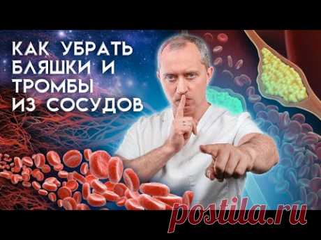 Как очистить сосуды от атеросклеротических бляшек и тромбов в домашних условиях?