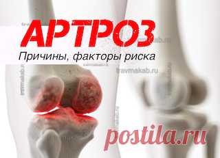 Артроз: причины развития и факторы риска | Врач травматолог-ортопед, онлайн кабинет