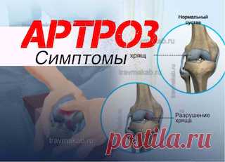 Клинические проявления остеоартроза: основные симптомы, типы боли | Врач травматолог-ортопед, онлайн кабинет