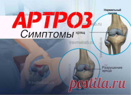 Клинические проявления остеоартроза: основные симптомы, типы боли | Врач травматолог-ортопед, онлайн кабинет