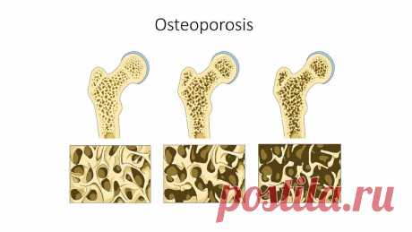 3 продукта которые укрепляют кости, но это не молоко: чем питаться чтоб не болеть остеопорозом | Кухня Технолога | Пульс Mail.ru