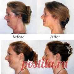 Tone double chin and get a defined jawline with face…