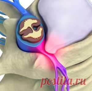 Грыжа - как лечить без операции и лекарств?!