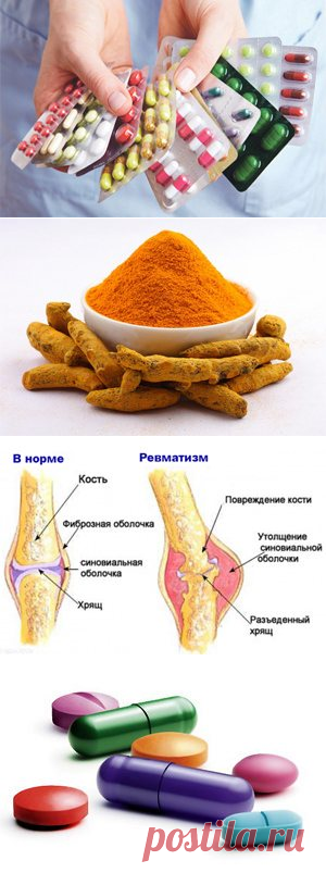 Ревматизм – лечение ревматизма современными и народными средствами - 5 самых эффективных средств!