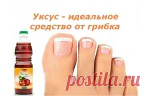 Поедашка.ру » Архив сайта » Лечение грибка ногтей уксусом