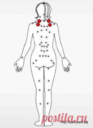 Точки китайской медицины при лечении опорно-двигательного аппарата приборами Шубоши - Комфорт