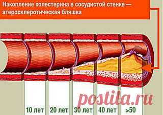 Старинный рецепт очищение сосудов от холестерина.